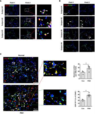 Identification of a distinct cluster of GDF15high macrophages induced by in vitro differentiation exhibiting anti-inflammatory activities